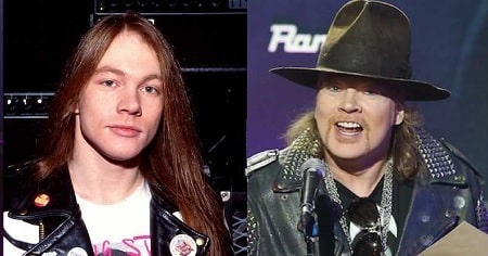 A picture of Axl Rose before (left) and after (right).